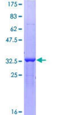 SDS-Page: Recombinant Human ZBTB20 Protein [H00026137-Q01] - 12.5% SDS-PAGE Stained with Coomassie Blue.