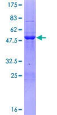 12.5% SDS-PAGE Stained with Coomassie Blue.