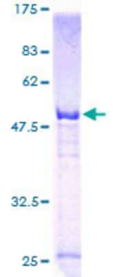 12.5% SDS-PAGE Stained with Coomassie Blue.