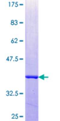 12.5% SDS-PAGE Stained with Coomassie Blue.