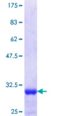 SDS-Page: Recombinant Human NKX2.8 Protein [H00026257-Q01] - 12.5% SDS-PAGE Stained with Coomassie Blue.