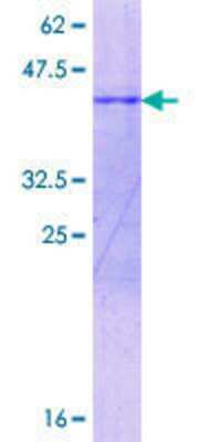 12.5% SDS-PAGE Stained with Coomassie Blue.
