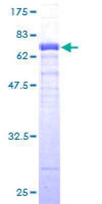 12.5% SDS-PAGE Stained with Coomassie Blue.