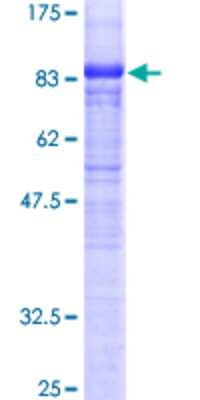 12.5% SDS-PAGE Stained with Coomassie Blue.