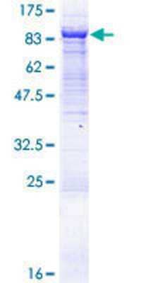 Other Recombinant Human VPS33B GST (N-Term) Protein