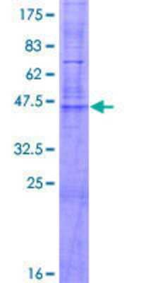 12.5% SDS-PAGE Stained with Coomassie Blue.