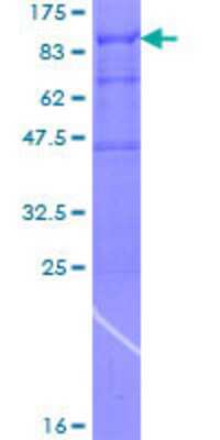 12.5% SDS-PAGE Stained with Coomassie Blue.