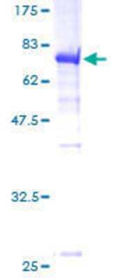 12.5% SDS-PAGE Stained with Coomassie Blue.