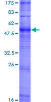 12.5% SDS-PAGE Stained with Coomassie Blue.