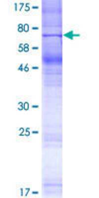 12.5% SDS-PAGE Stained with Coomassie Blue.