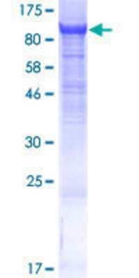 12.5% SDS-PAGE Stained with Coomassie Blue.