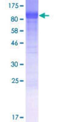 12.5% SDS-PAGE Stained with Coomassie Blue.