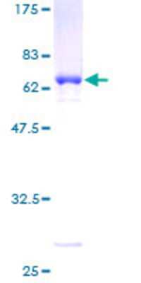 12.5% SDS-PAGE Stained with Coomassie Blue.