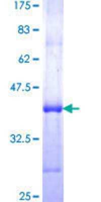 Recombinant Human Myoferlin Protein [H00026509-Q01] - 12.5% SDS-PAGE Stained with Coomassie Blue.