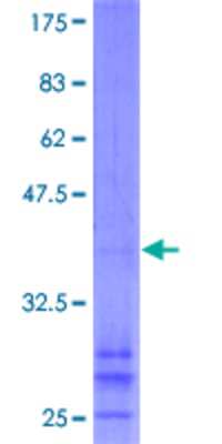 Other Recombinant Human CHIC2 GST (N-Term) Protein