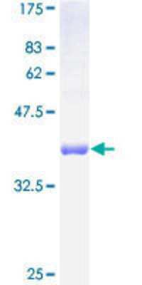 SDS-Page: Recombinant Human FXC1 Protein [H00026515-P01] - 12.5% SDS-PAGE Stained with Coomassie Blue.