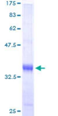 12.5% SDS-PAGE Stained with Coomassie Blue.