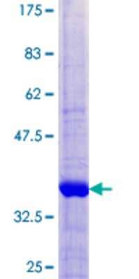 SDS-PAGE Recombinant Human TIMM8B GST (N-Term) Protein