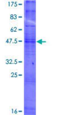12.5% SDS-PAGE Stained with Coomassie Blue.