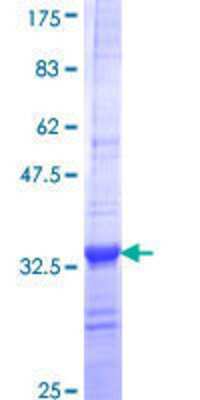 12.5% SDS-PAGE Stained with Coomassie Blue.