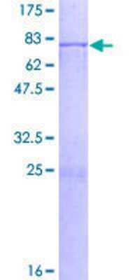 Other Recombinant Human TBL2 GST (N-Term) Protein