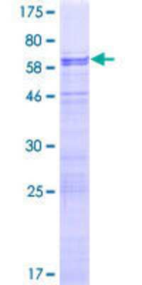 12.5% SDS-PAGE Stained with Coomassie Blue.