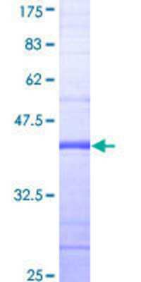 12.5% SDS-PAGE Stained with Coomassie Blue.