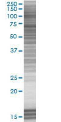 HAVCR1 transfected lysate.