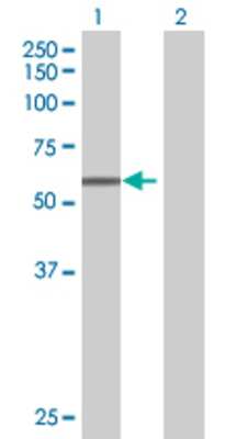 Lane 1: HAVCR1 transfected lysate (39.2 KDa) Lane 2: Non-transfected lysate.