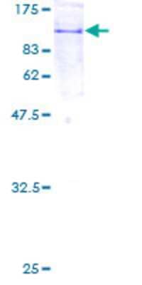 12.5% SDS-PAGE Stained with Coomassie Blue.