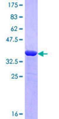 SDS-Page: Recombinant Human Neurobeachin Protein [H00026960-Q01] - 12.5% SDS-PAGE Stained with Coomassie Blue.