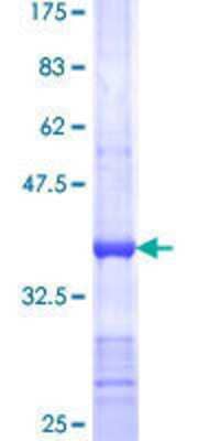 Other Recombinant Human CYFIP2 GST (N-Term) Protein