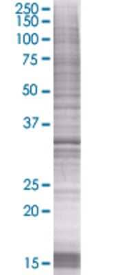 ZBTB32 transfected lysate.