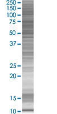 CLUL1 transfected lysate.