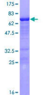 12.5% SDS-PAGE Stained with Coomassie Blue.