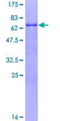 12.5% SDS-PAGE Stained with Coomassie Blue.