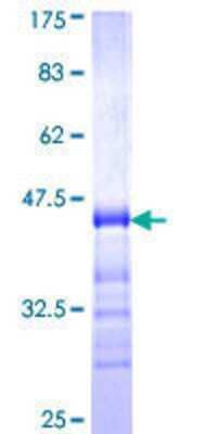 SDS-PAGE Recombinant Human TJP3 GST (N-Term) Protein