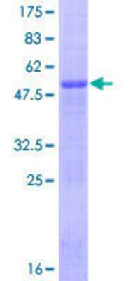 SDS-PAGE Recombinant Human CIDEB GST (N-Term) Protein