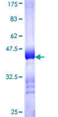 12.5% SDS-PAGE Stained with Coomassie Blue.