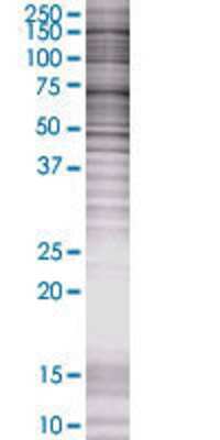 STK36 transfected lysate.