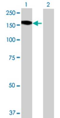 Lane 1: STK36 transfected lysate (144.76 KDa) Lane 2: Non-transfected lysate.
