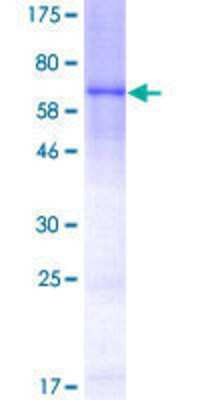 SDS-Page: Recombinant Human Ago2/eIF2C2 Protein [H00027161-P02] - 12.5% SDS-PAGE Stained with Coomassie Blue.