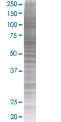 SESN1 transfected lysate.