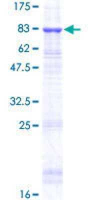 12.5% SDS-PAGE Stained with Coomassie Blue.