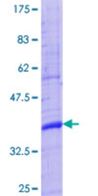 12.5% SDS-PAGE Stained with Coomassie Blue.