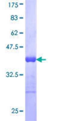 12.5% SDS-PAGE Stained with Coomassie Blue.