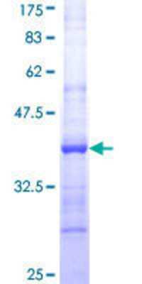 12.5% SDS-PAGE Stained with Coomassie Blue.