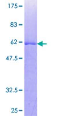 Other Recombinant Human TP53TG5 GST (N-Term) Protein