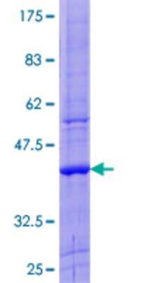 Other Recombinant Human ZNF544 GST (N-Term) Protein