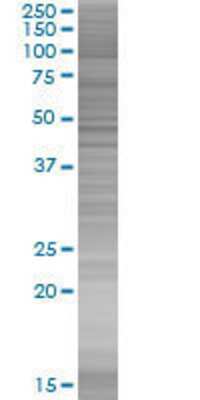 ZNF544 transfected lysate.